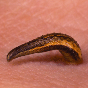 leech on skin
